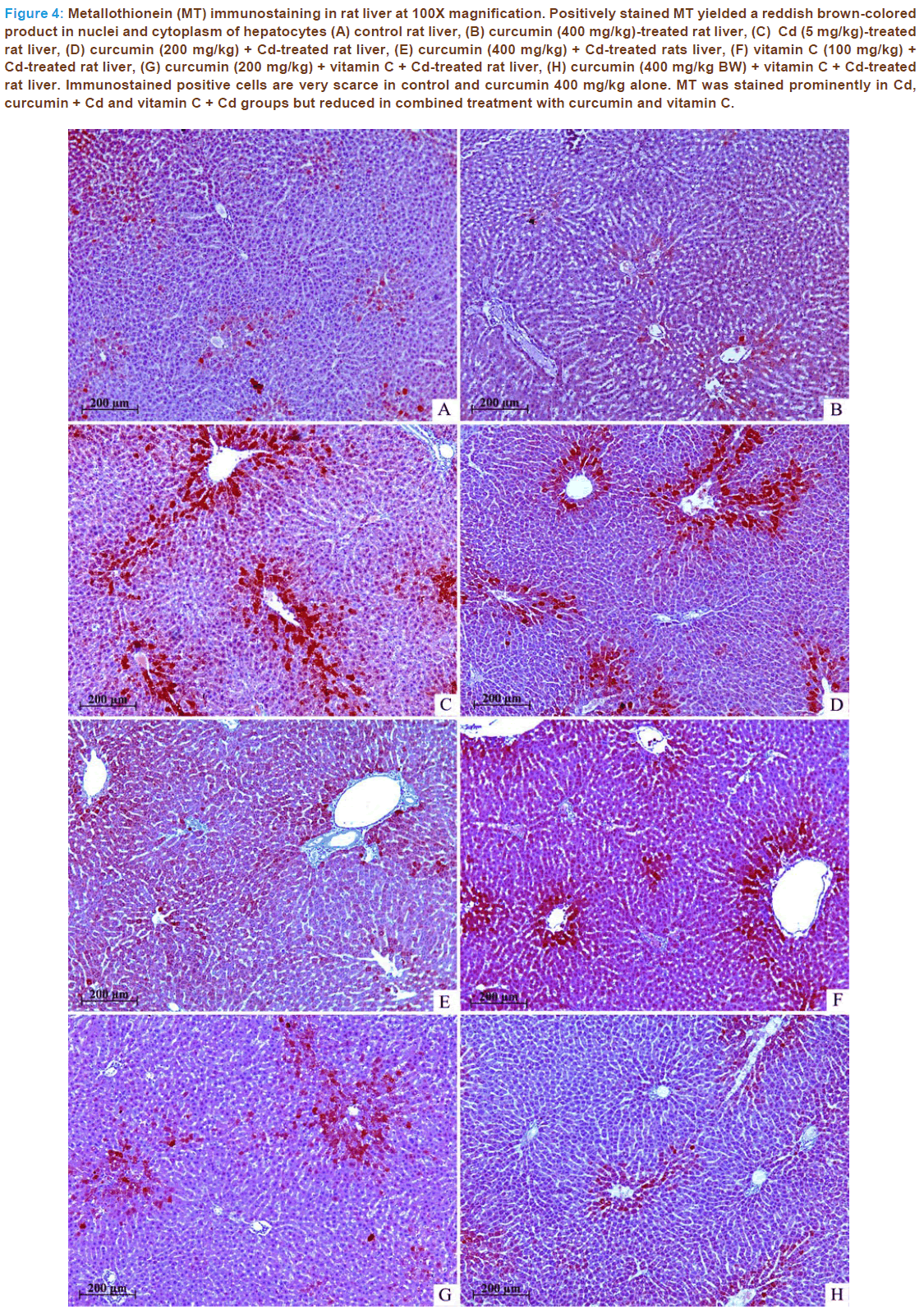 Basic-Clinical-Pharmacy-Metallothionein-immunostaining-rat