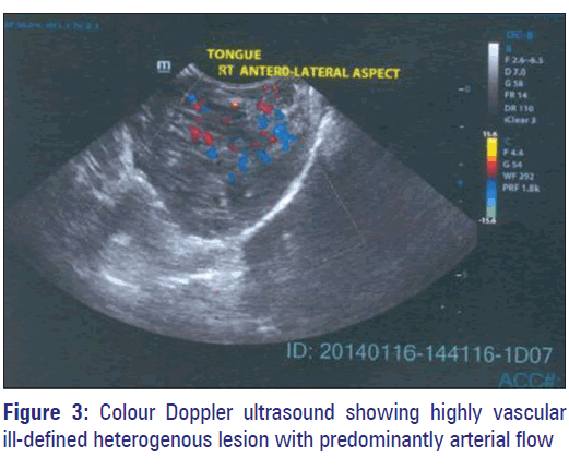 Basic-clinical-pharmacy-Colour-Doppler-ultrasound