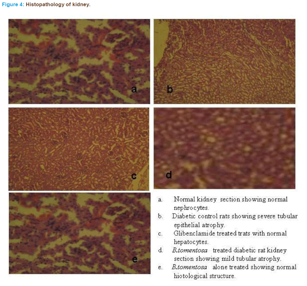 Basic-clinical-pharmacy-Histopathology-kidney