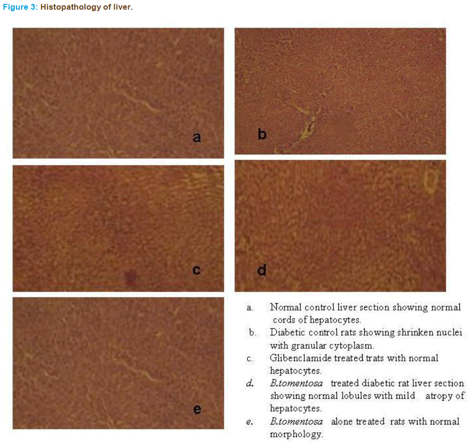 Basic-clinical-pharmacy-Histopathology-liver