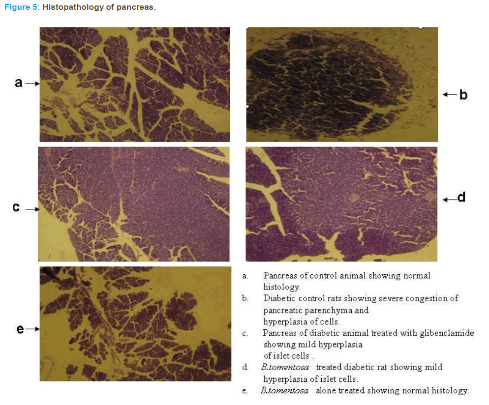 Basic-clinical-pharmacy-Histopathology-pancreas