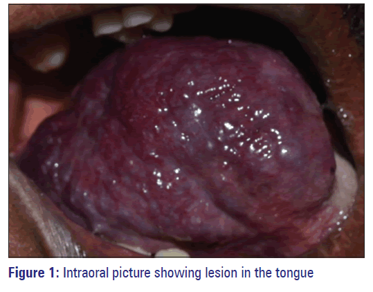 Basic-clinical-pharmacy-Intraoral-picture