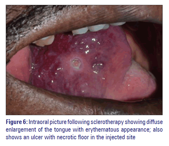 Basic-clinical-pharmacy-Intraoral-picture