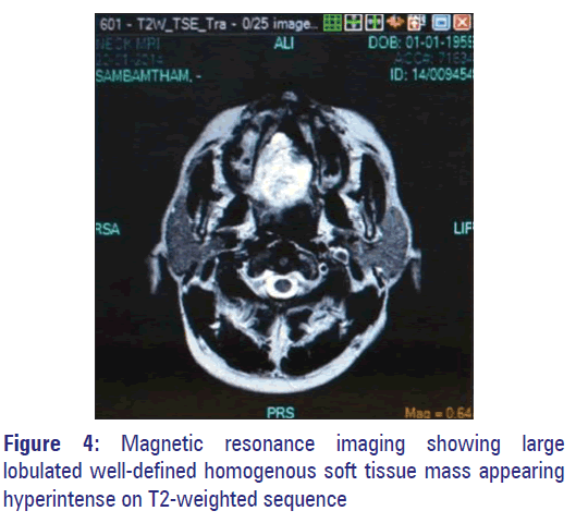Basic-clinical-pharmacy-Magnetic-resonance-imaging