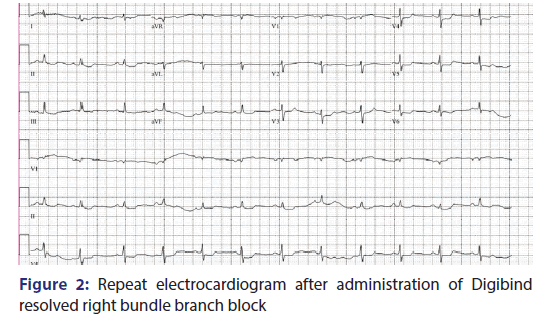 Basic-clinical-pharmacy-Repeat-electrocardiogram