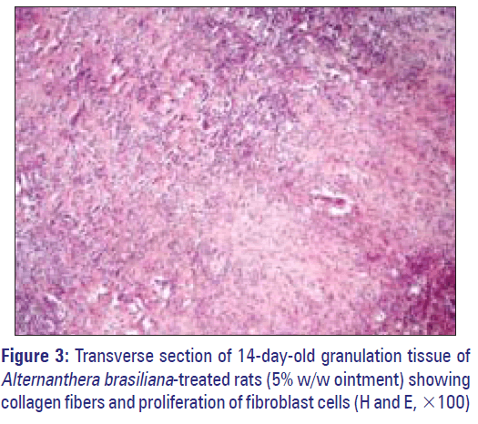 Basic-clinical-pharmacy-granulation-tissue