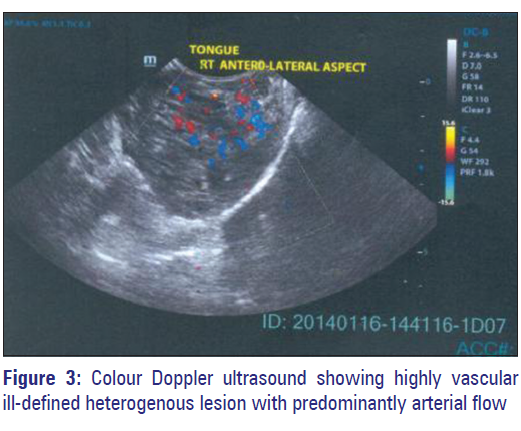 Basic-clinical-pharmacy-tongue-lesion