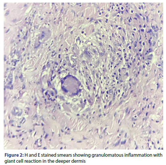 basic-clinical-pharmacy-granulomatous